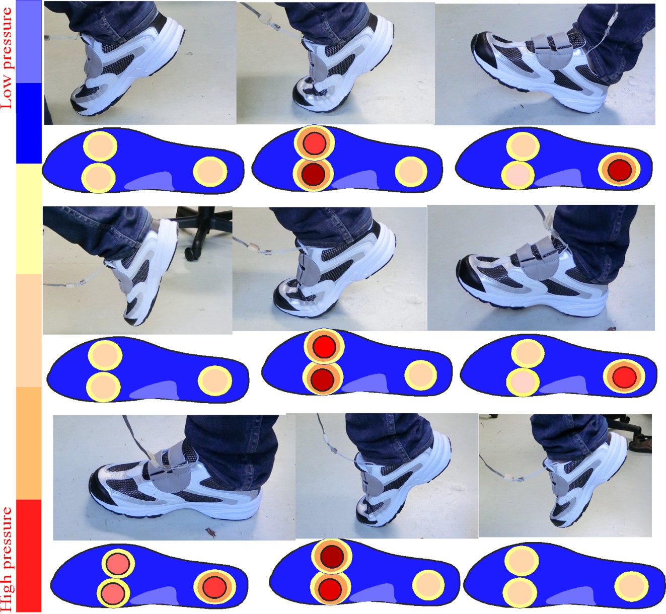 Foot Pressure Distribution